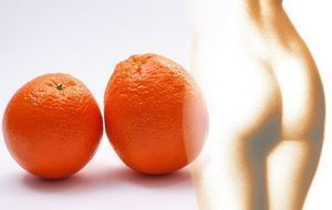 orangenhaut-cellulite
